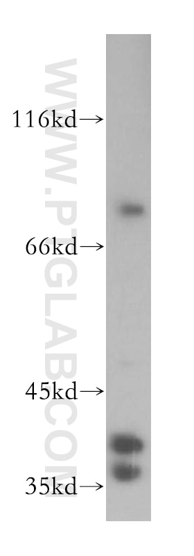 Western Blot (WB) analysis of HeLa cells using SUGT1 Polyclonal antibody (11675-1-AP)