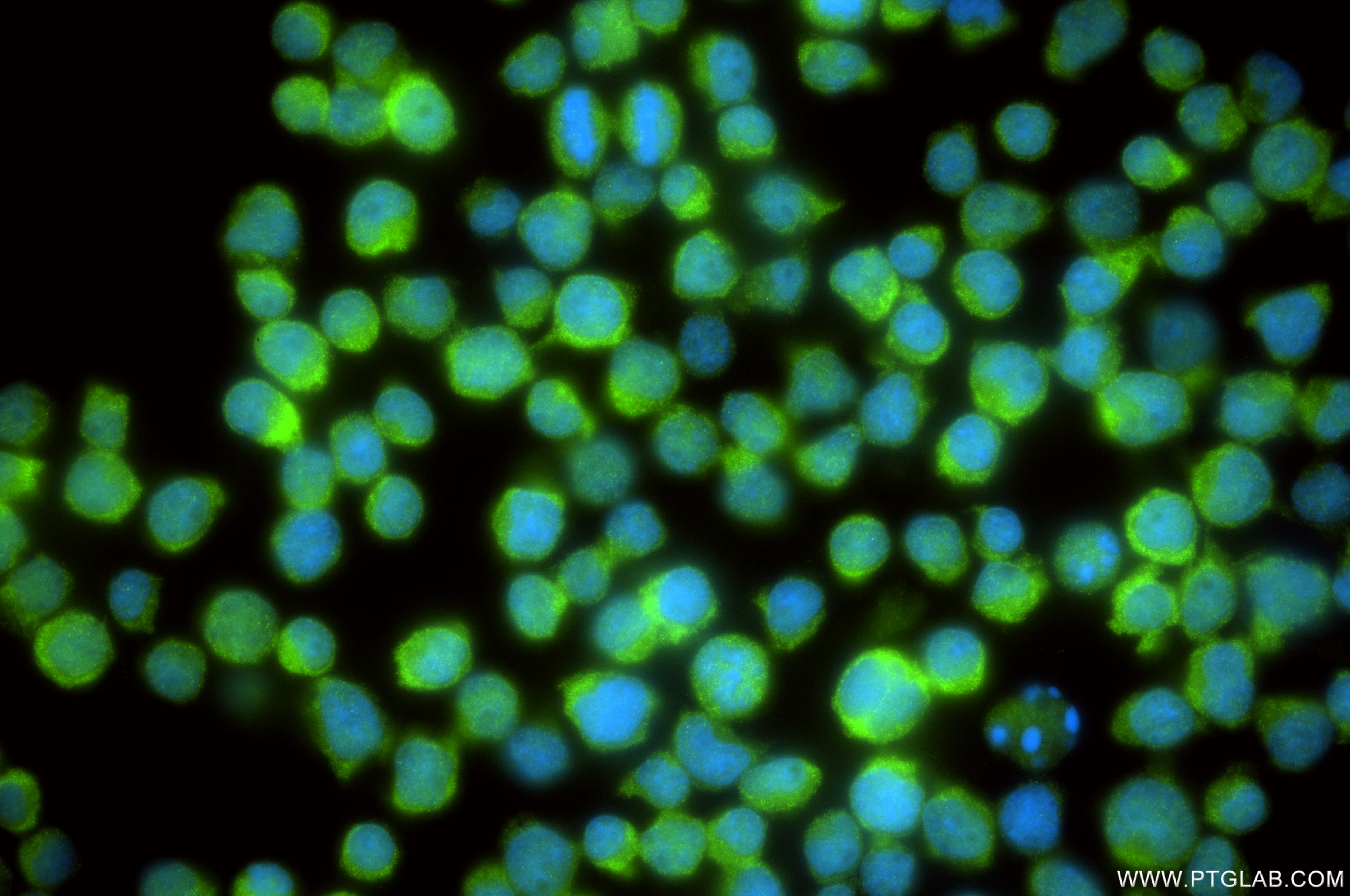 Immunofluorescence (IF) / fluorescent staining of Jurkat cells using SUGT1 Recombinant antibody (84963-5-RR)