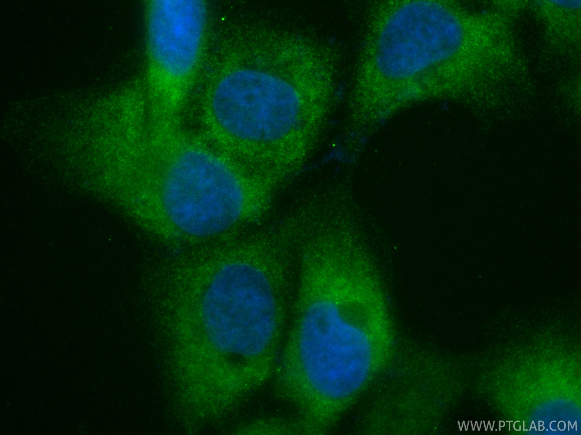 IF Staining of A431 using CL488-84963-5 Immunofluorescence (IF) / fluorescent staining of A431 cells using CoraLite® Plus 488-conjugated SUGT1 Recombinant mo (CL488-84963-5)