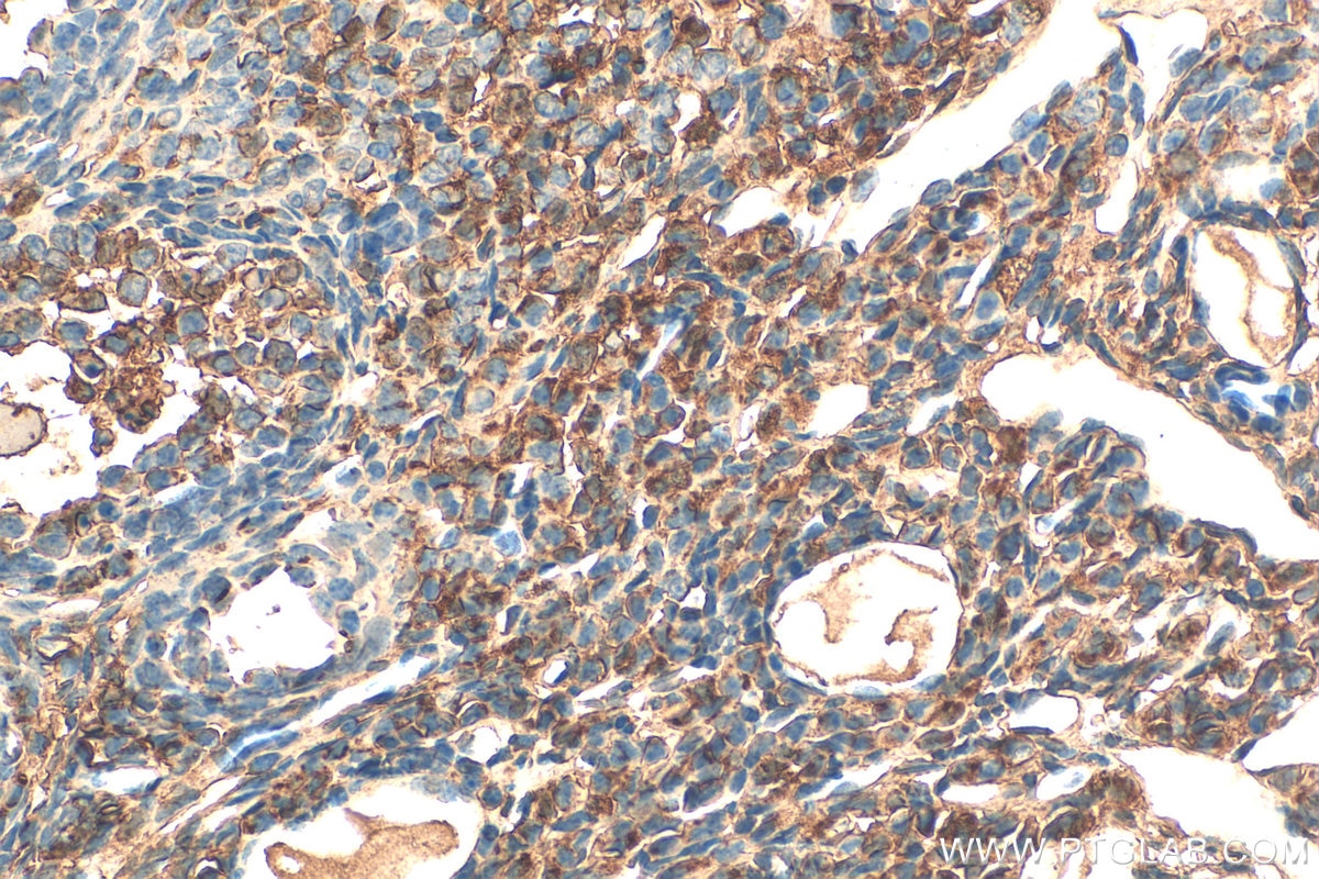 Immunohistochemistry (IHC) staining of mouse ovary tissue using SULF2 Polyclonal antibody (12260-1-AP)