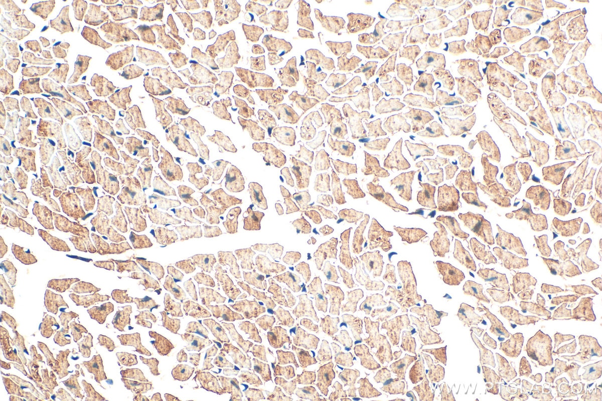 Immunohistochemistry (IHC) staining of mouse heart tissue using SULF2 Polyclonal antibody (12260-1-AP)