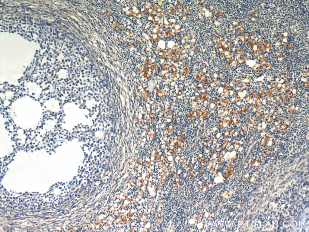 IHC staining of human ovary using 12260-1-AP