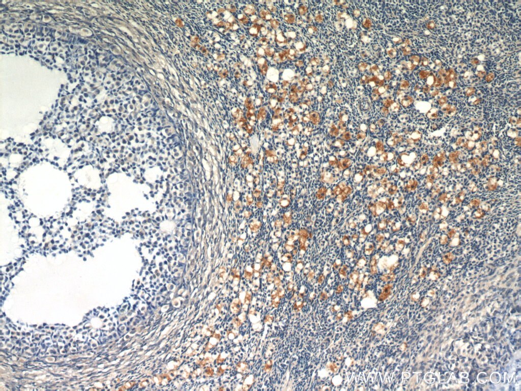 Immunohistochemistry (IHC) staining of human ovary tissue using SULF2 Polyclonal antibody (12260-1-AP)