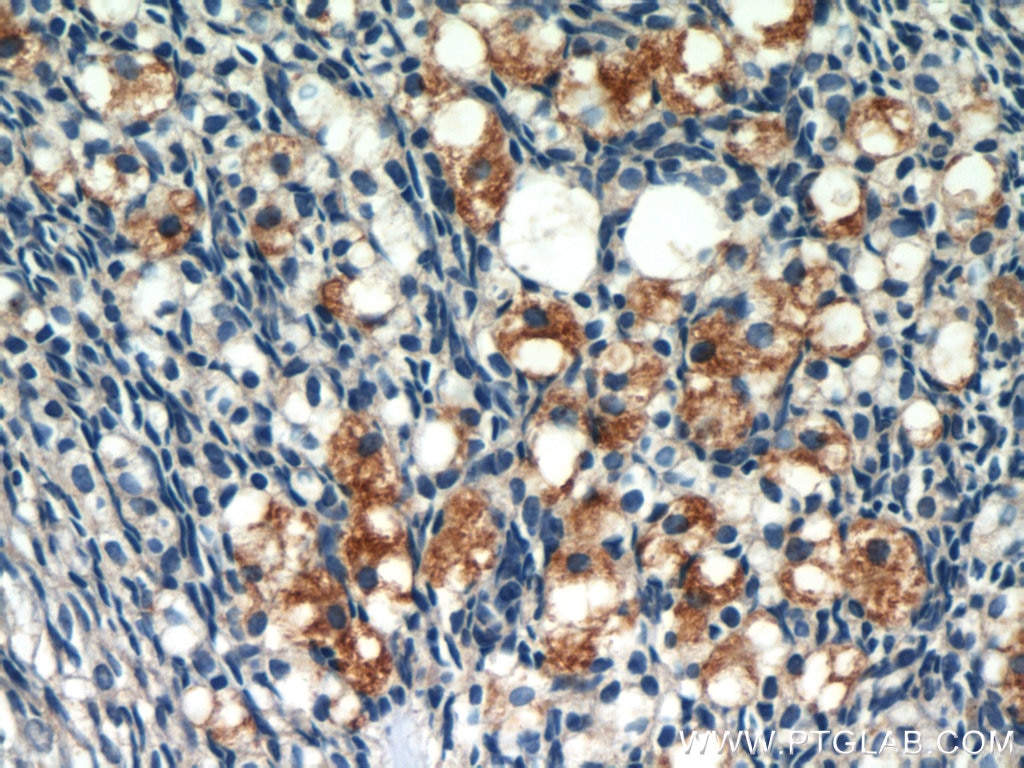 Immunohistochemistry (IHC) staining of human ovary tissue using SULF2 Polyclonal antibody (12260-1-AP)