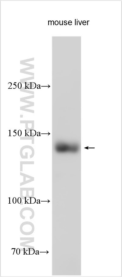 Western Blot (WB) analysis of various lysates using SULF2 Polyclonal antibody (29591-1-AP)