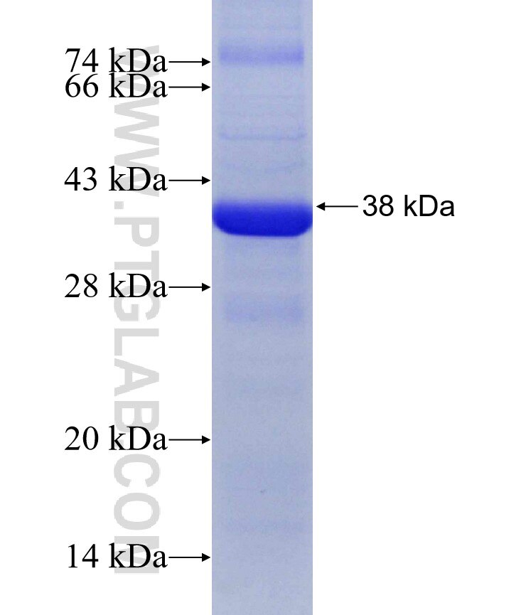 SULF2 fusion protein Ag31106 SDS-PAGE