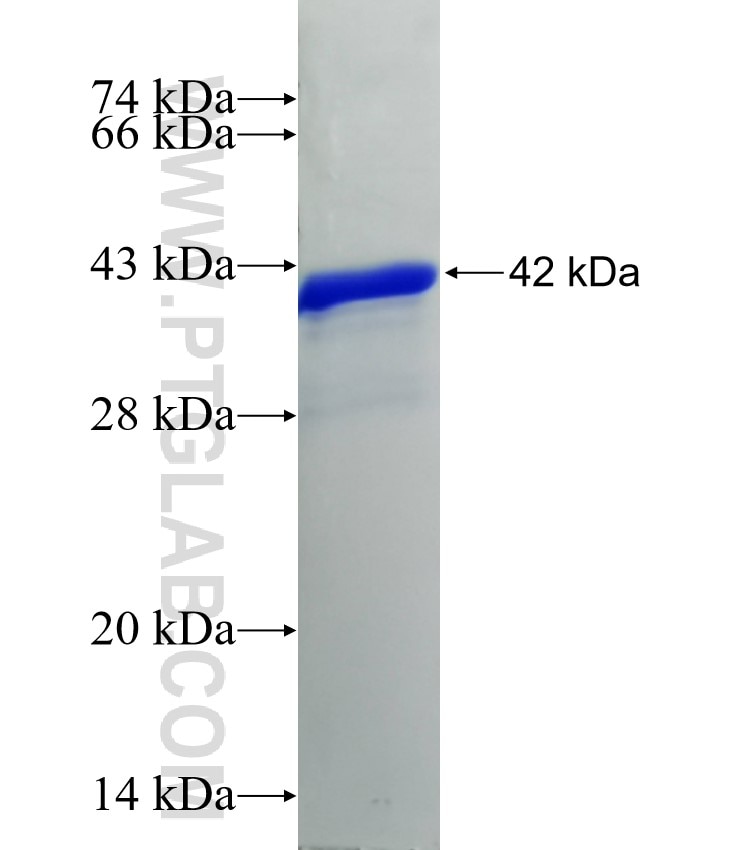 SULF2 fusion protein Ag2915 SDS-PAGE