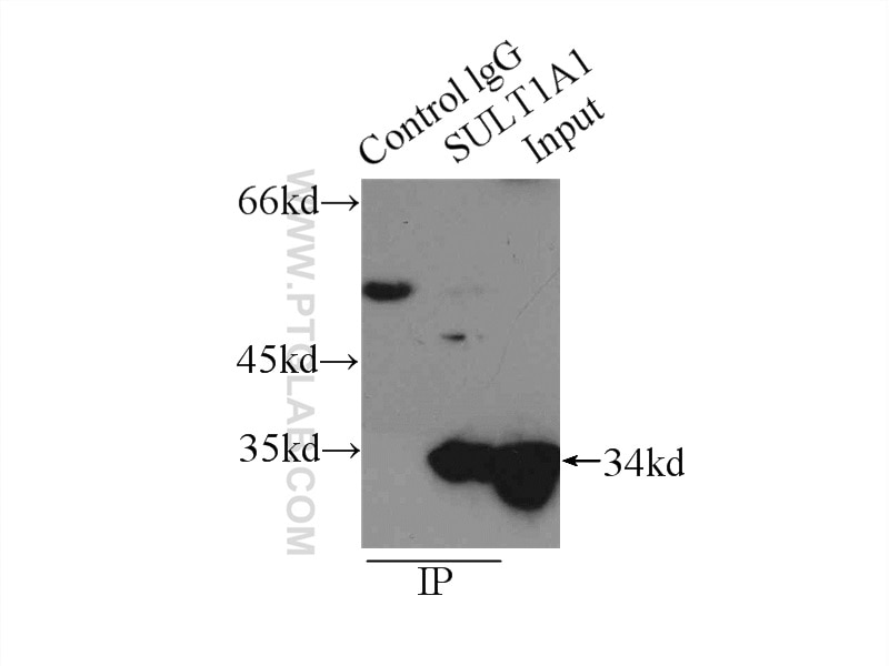 Immunoprecipitation (IP) experiment of mouse liver tissue using SULT1A1 Polyclonal antibody (10911-2-AP)