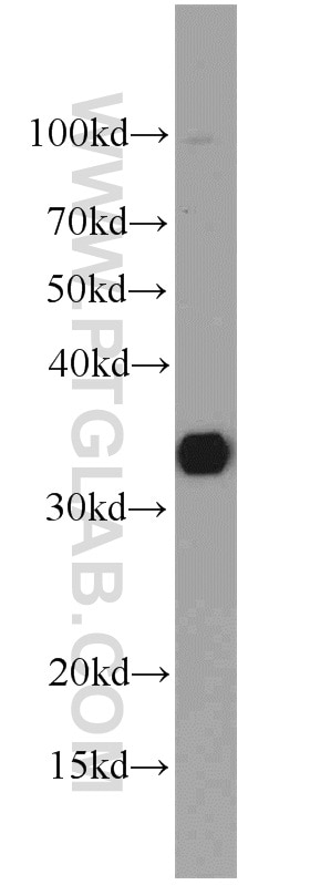 Western Blot (WB) analysis of mouse liver tissue using SULT1A1 Polyclonal antibody (10911-2-AP)