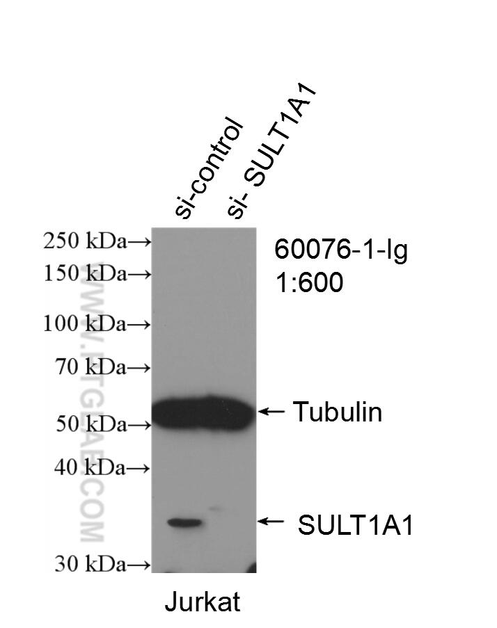 Western Blot (WB) analysis of Jurkat cells using SULT1A1 Monoclonal antibody (60076-1-Ig)