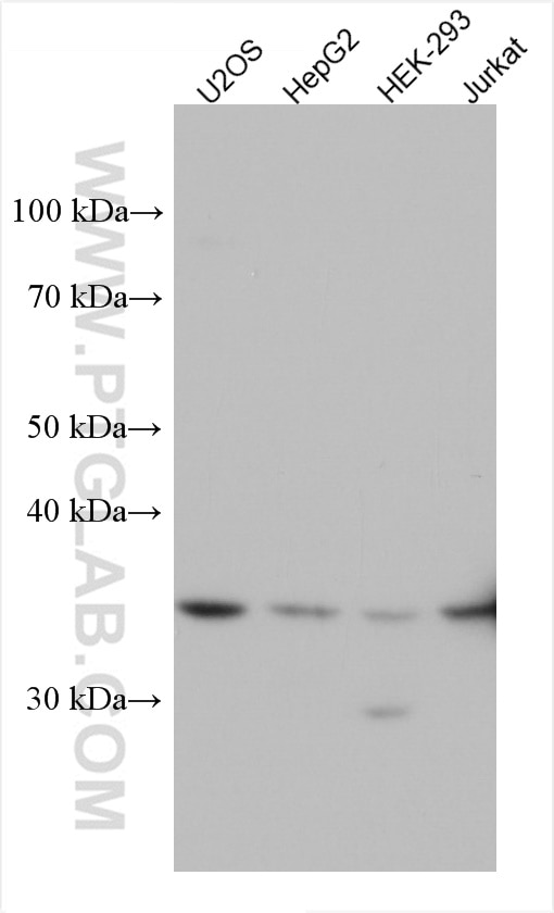 Western Blot (WB) analysis of various lysates using SULT1A1 Monoclonal antibody (60076-1-Ig)