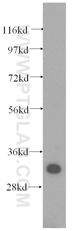 Western Blot (WB) analysis of human placenta tissue using SULT1A1 Monoclonal antibody (60076-1-Ig)