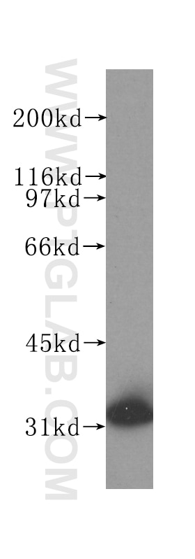 Western Blot (WB) analysis of human liver tissue using SULT1A1 Monoclonal antibody (60076-1-Ig)