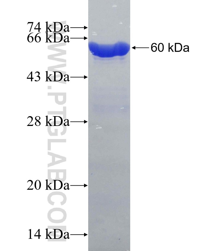 SULT1A1 fusion protein Ag1344 SDS-PAGE