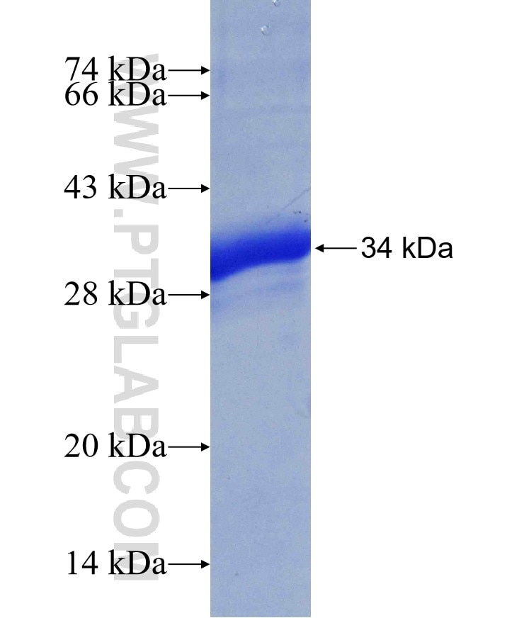 SULT1A1 fusion protein Ag4611 SDS-PAGE
