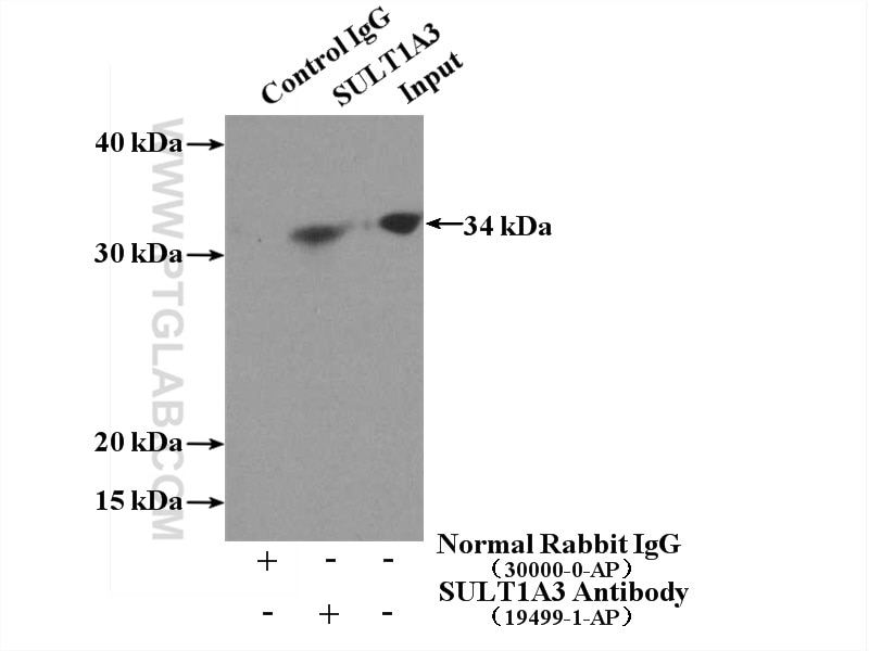 Immunoprecipitation (IP) experiment of COLO 320 cells using SULT1A3 Polyclonal antibody (19499-1-AP)