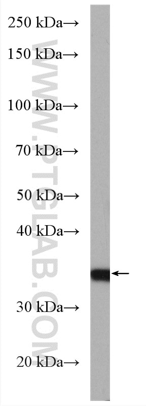 Western Blot (WB) analysis of mouse liver tissue using SULT1A3 Polyclonal antibody (19499-1-AP)