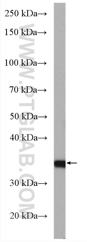 WB analysis of mouse liver using 19499-1-AP