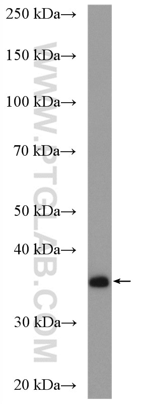 WB analysis of COLO 320 using 19499-1-AP