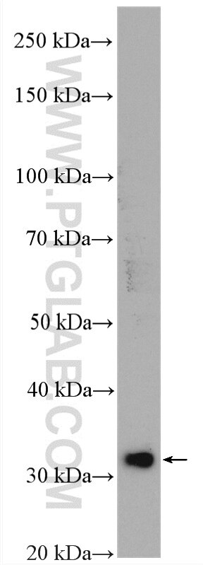 WB analysis of Caco-2 using 19499-1-AP