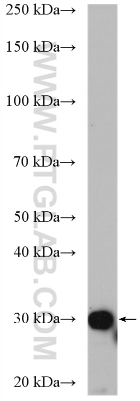 Western Blot (WB) analysis of MCF-7 cells using SULT1A3 Polyclonal antibody (19499-1-AP)