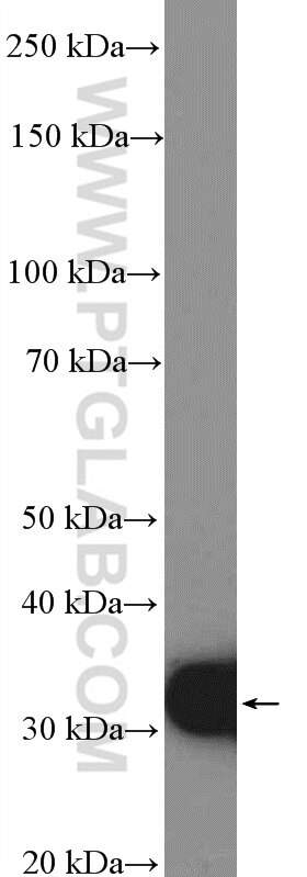 Western Blot (WB) analysis of mouse pancreas tissue using SULT1A4 Polyclonal antibody (11376-1-AP)