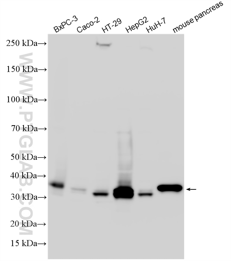 WB analysis using 11376-1-AP Western Blot (WB) analysis of various lysates using SULT1A4 Polyclonal antibody (11376-1-AP)