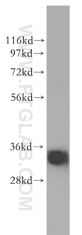 Western Blot (WB) analysis of human colon tissue using SULT1A4 Polyclonal antibody (11376-1-AP)