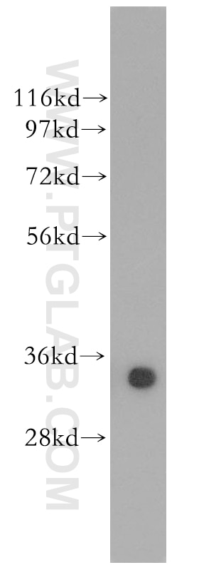 Western Blot (WB) analysis of human pancreas tissue using SULT1A4 Polyclonal antibody (11376-1-AP)
