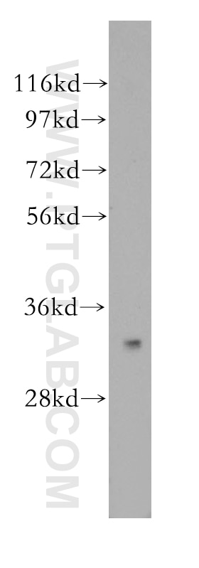 Western Blot (WB) analysis of HepG2 cells using SULT1A4 Polyclonal antibody (11376-1-AP)