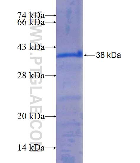 SULT1A4 fusion protein Ag25111 SDS-PAGE