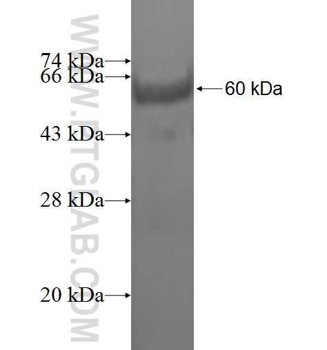 SULT1A4 fusion protein Ag1935 SDS-PAGE