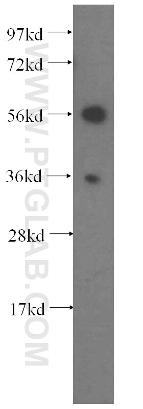 SULT1B1