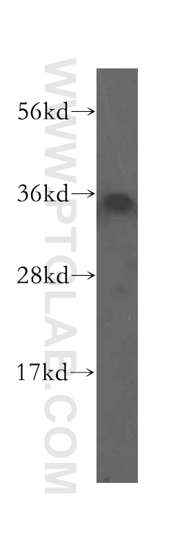 Western Blot (WB) analysis of human colon tissue using SULT1B1 Polyclonal antibody (16050-1-AP)