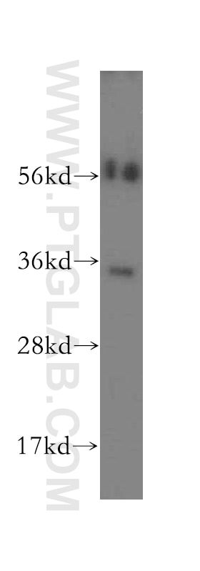Western Blot (WB) analysis of human liver tissue using SULT1B1 Polyclonal antibody (16050-1-AP)