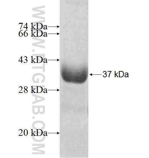 SULT1B1 fusion protein Ag8993 SDS-PAGE