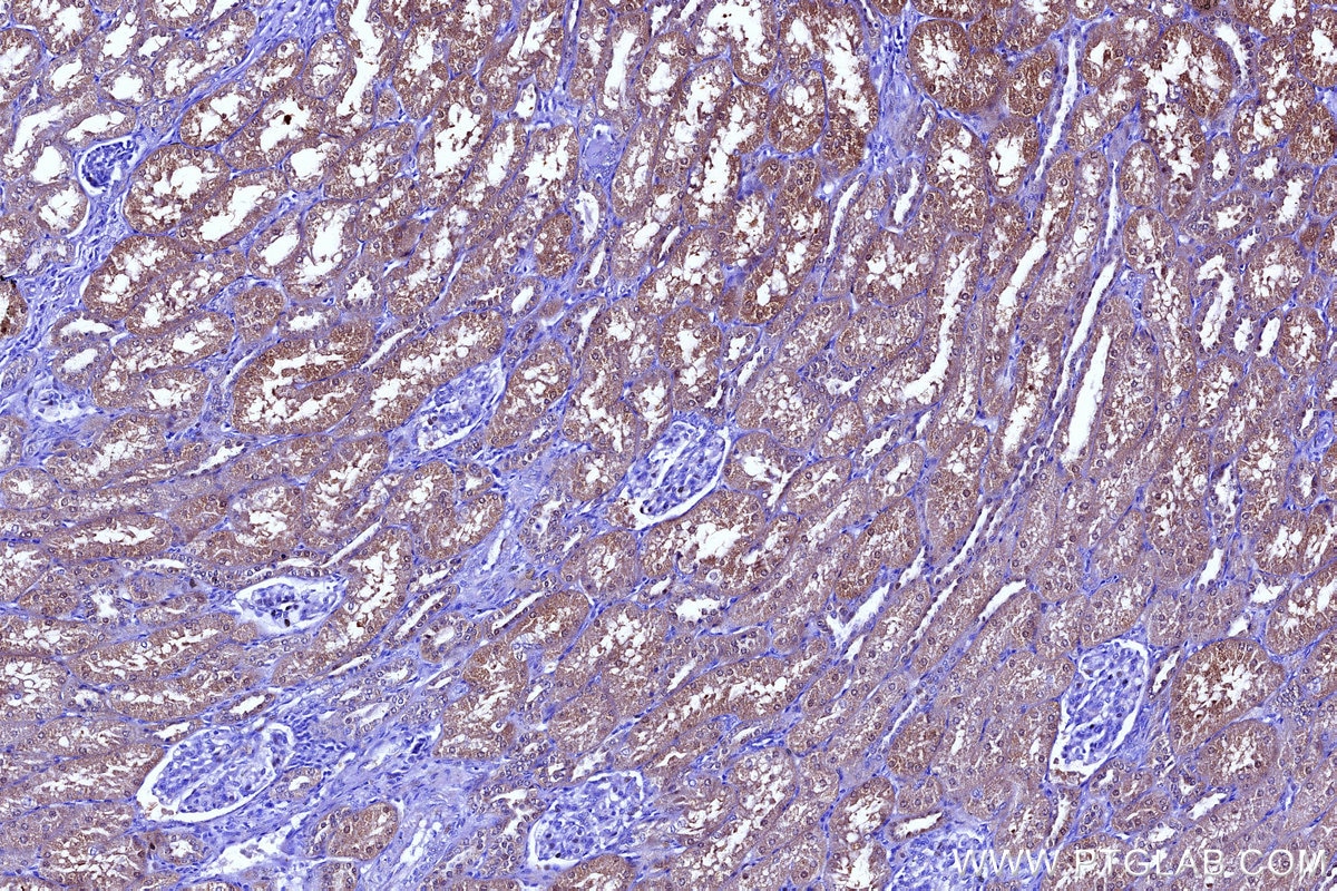 Immunohistochemistry (IHC) staining of human kidney tissue using SULT1C2 Polyclonal antibody (10662-1-AP)