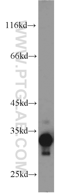 Western Blot (WB) analysis of human kidney tissue using SULT1C2 Polyclonal antibody (10662-1-AP)