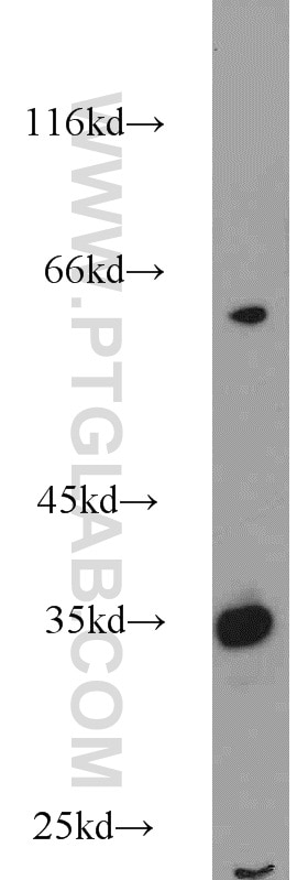 Western Blot (WB) analysis of human liver tissue using SULT1C2 Polyclonal antibody (10662-1-AP)