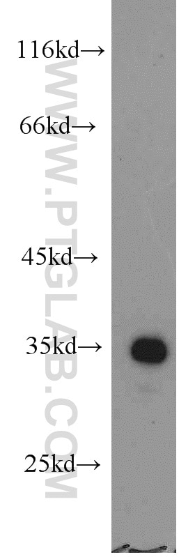 Western Blot (WB) analysis of human stomach tissue using SULT1C2 Polyclonal antibody (10662-1-AP)