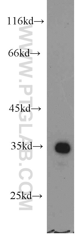 Western Blot (WB) analysis of human stomach tissue using SULT1C2 Polyclonal antibody (10662-1-AP)