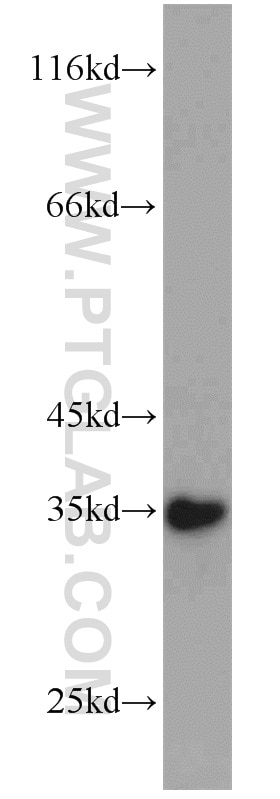Western Blot (WB) analysis of human stomach tissue using SULT1C2 Polyclonal antibody (10662-1-AP)