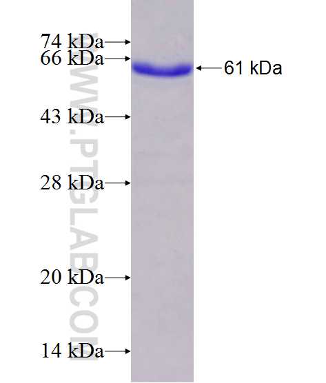 SULT1C2 fusion protein Ag1064 SDS-PAGE
