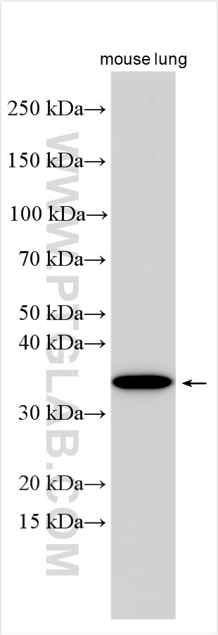 Western Blot (WB) analysis of various lysates using SULT1C4 Polyclonal antibody (14300-1-AP)