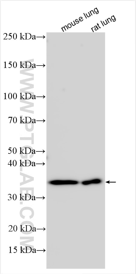 Western Blot (WB) analysis of various lysates using SULT1C4 Polyclonal antibody (14300-1-AP)