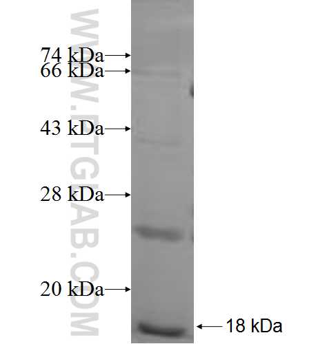 SULT1C4 fusion protein Ag5804 SDS-PAGE