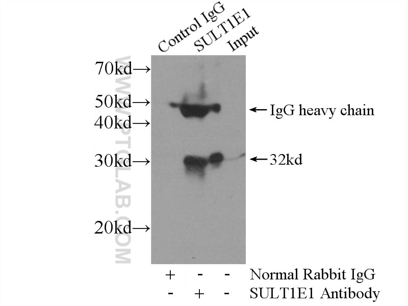 Immunoprecipitation (IP) experiment of mouse liver tissue using SULT1E1 Polyclonal antibody (12522-1-AP)