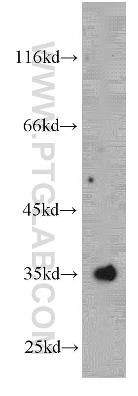 Western Blot (WB) analysis of mouse kidney tissue using SULT1E1 Polyclonal antibody (12522-1-AP)