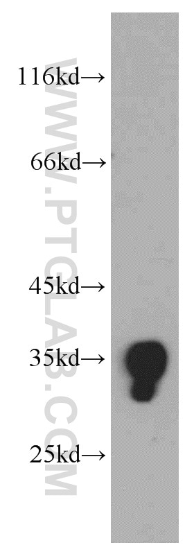 Western Blot (WB) analysis of human adrenal gland tissue using SULT1E1 Polyclonal antibody (12522-1-AP)