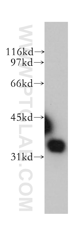 Western Blot (WB) analysis of human kidney tissue using SULT1E1 Polyclonal antibody (12522-1-AP)